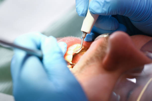 Best Emergency Treatment for Toothache in Lompoc, CA